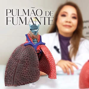 Dra Daniela Fudo Pneumologista explica como é um pulmão de fumante